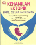 Kehamilan Ektopik : Hamil Diluar Kandungan
